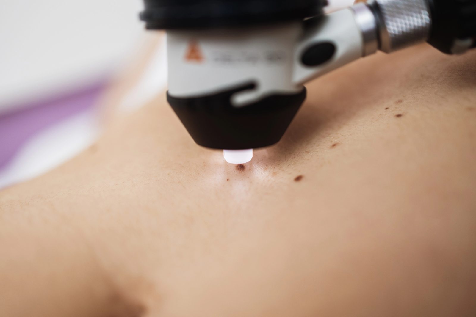Prijateljici je dermatologija nekaj izredno zanimivega